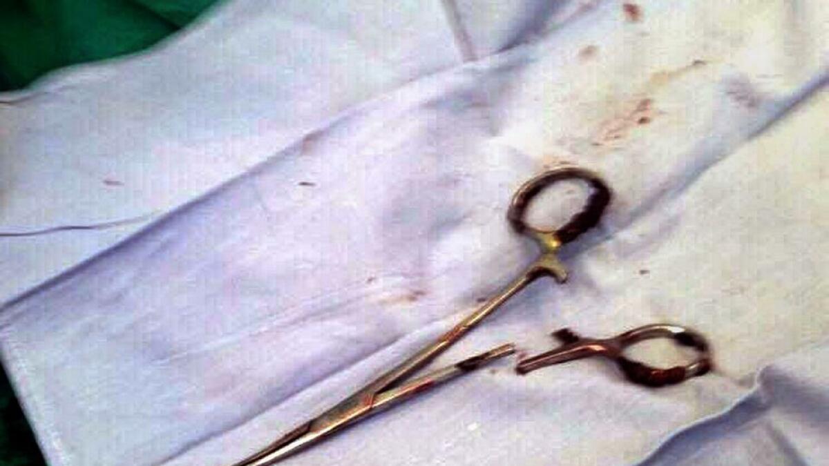 Scissors Pulled Out From Mans Stomach 18 Years After Surgery News Khaleej Times