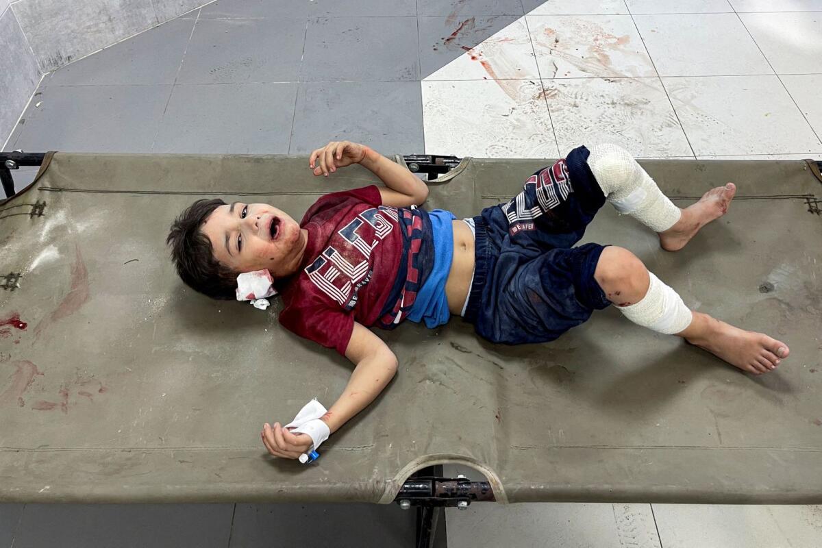A Palestinian boy, who was wounded in an Israeli strike, cries at Shifa hospital in Gaza City,  on Sunday. — Reuters