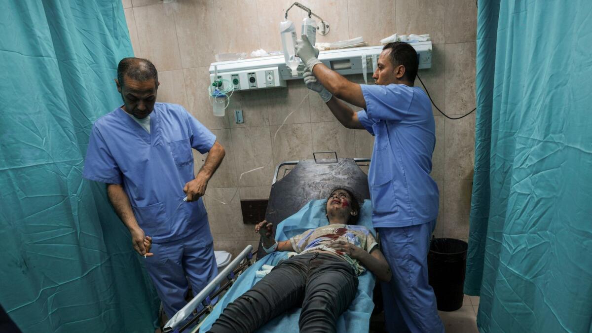 A Palestinian girl wounded during an Israeli airstrike receives medical treatment at Al Aqsa hospital in Deir El Balah, central Gaza Strip, on Sunday. — AP