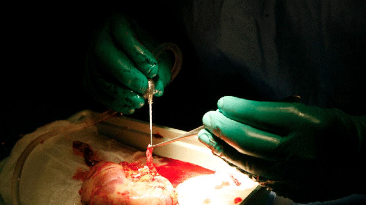 Worker forced to sell kidney to repay loan in India