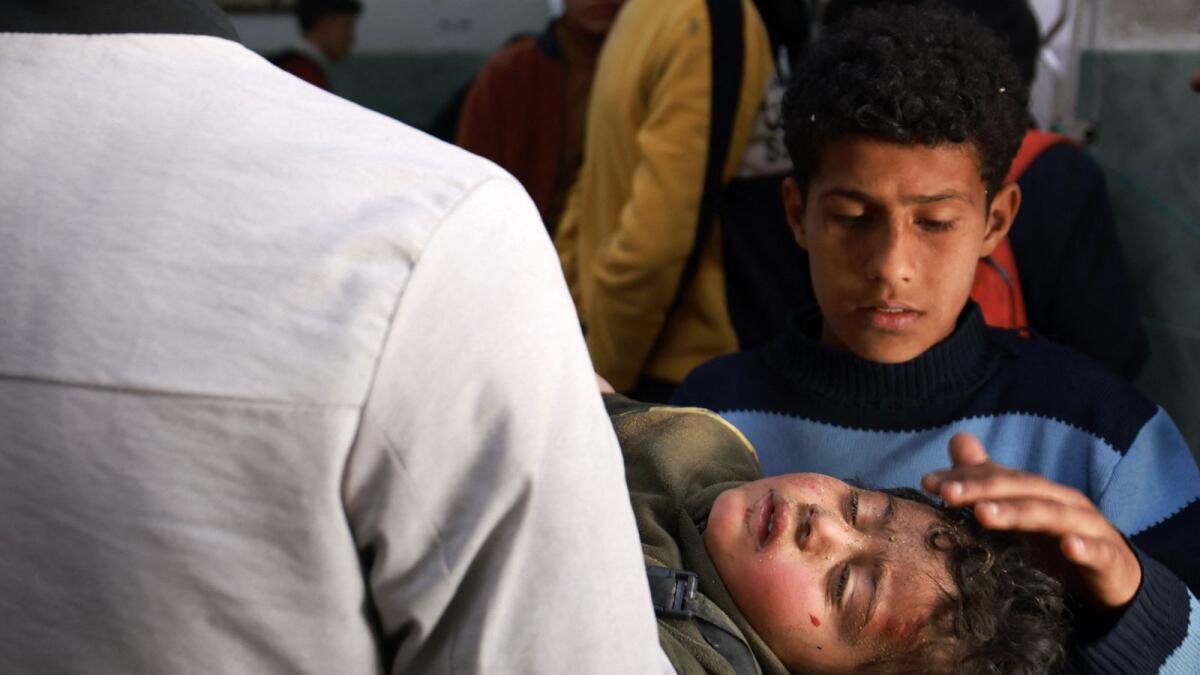 A young boy caresses the head of a young victim of Israeli bombardment at Al Najjar hospital in Rafah. — AFP