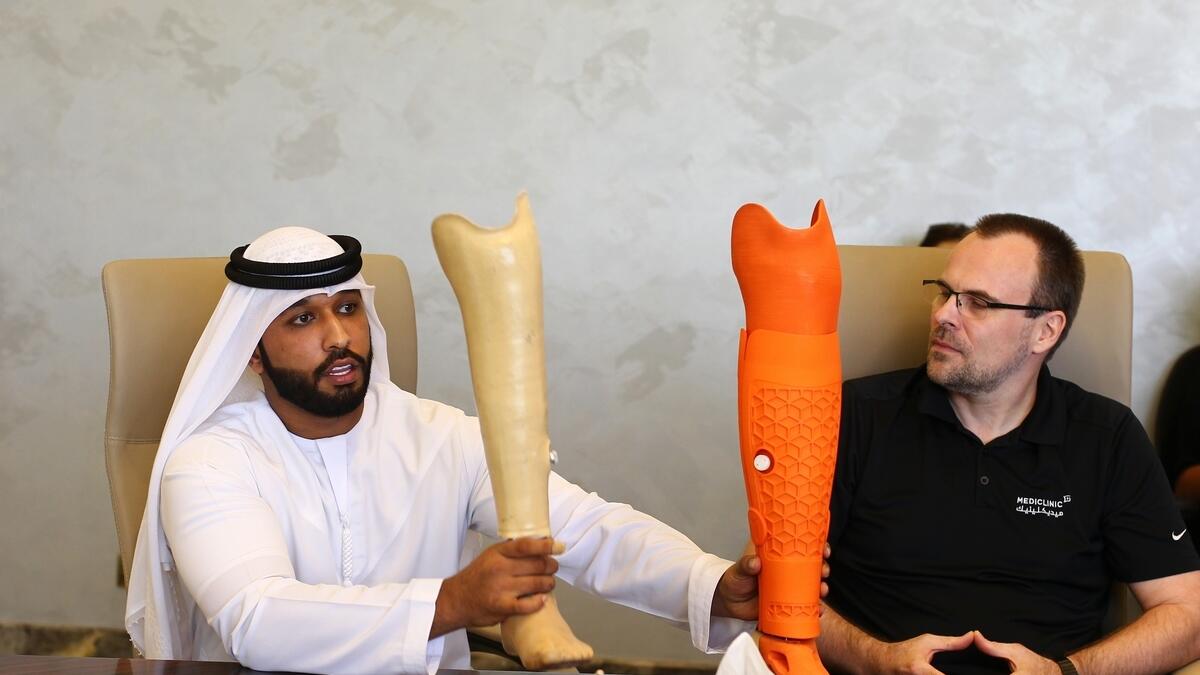 3D-printed legs lets Emirati double amputee walk pain-free