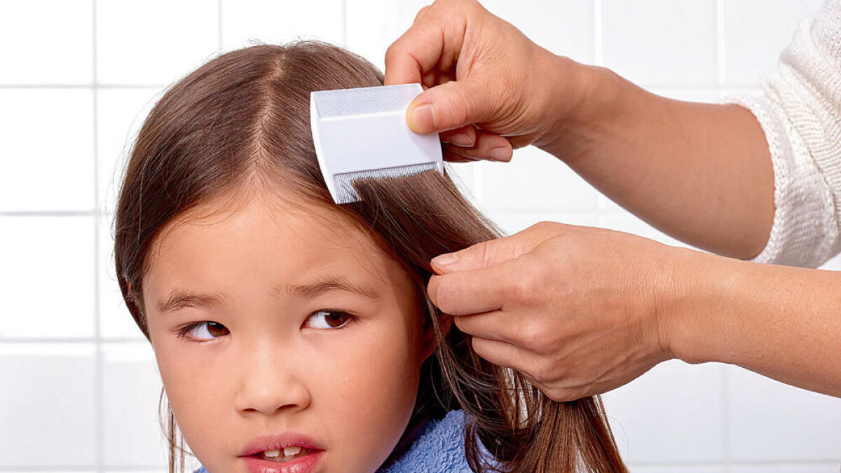 The best way to beat lice!