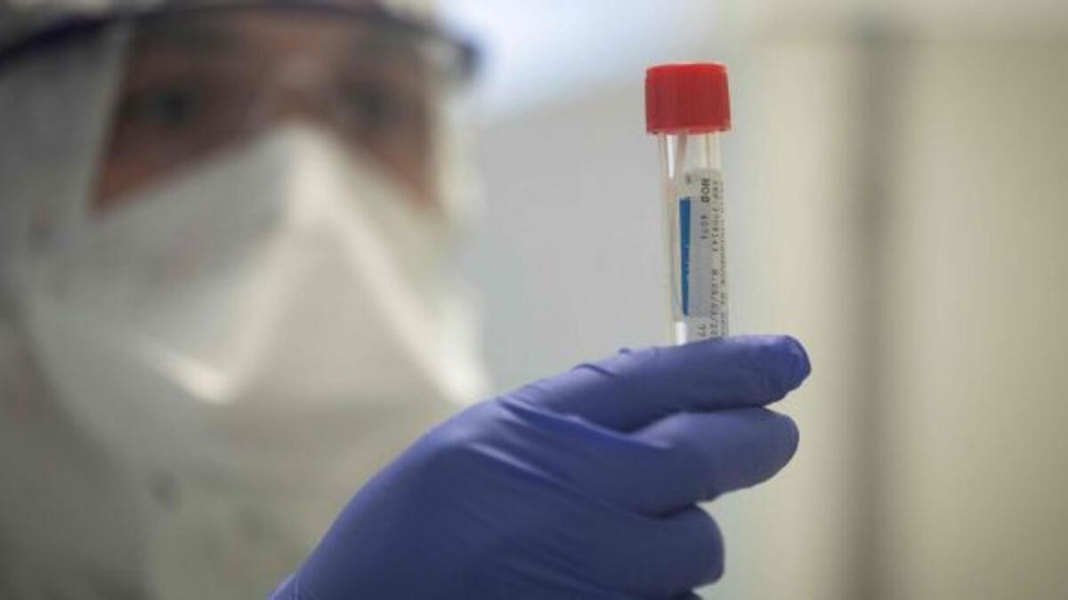 Coronavirus: les EAU signalent 83 cas de Covid-19, 113 guérisons, aucun décès – Actualités
