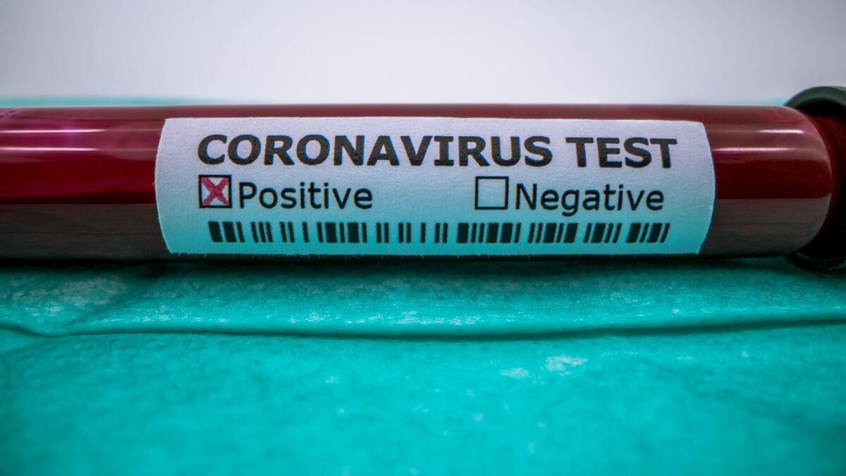 coronavirus, covid-19, sharjah