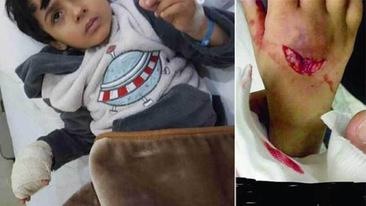 Wolf bites hand of 3-year-old boy in Saudi Arabia