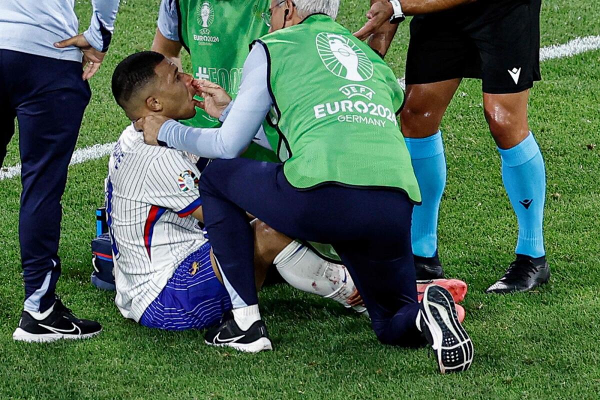 French forward Kylian Mbappe receives medical attention after breaking his nose in a collision during the match against Austria. — AFP