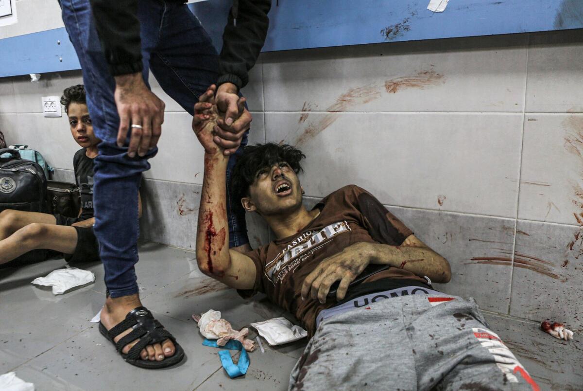 Wounded Palestinians lay on the floor at aAl Shifa hospital. — AP
