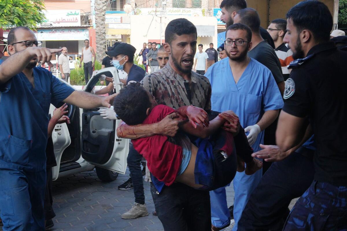 A Palestinian child wounded in Israeli bombardment is brought to a hospital in Deir El Balah, Gaza Strip, on Tuesday. — AP