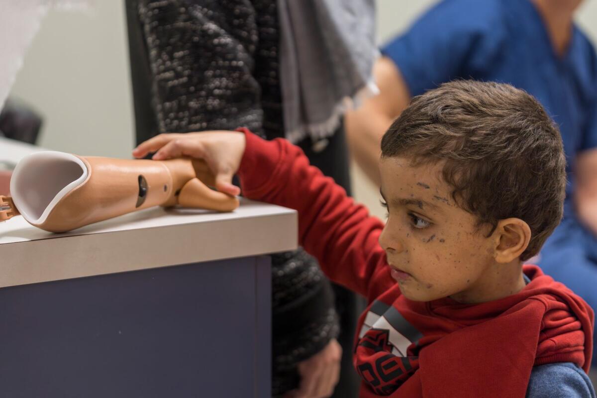 Four-year-old Omar Abu Kuwaik examines his new prosthetic arm at Shriners Children's Hospital on Feb. 28, 2024, in Philadelphia. — AP