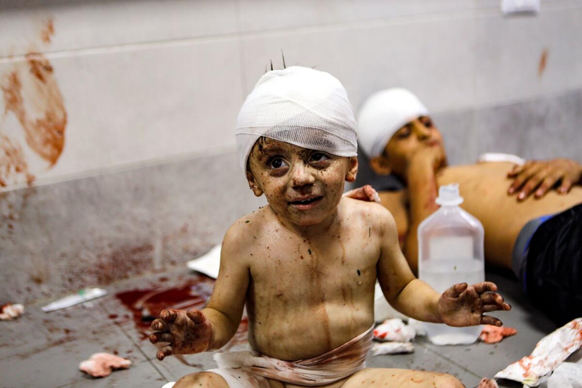 Wounded Palestinian children lay at the Al Shifa hospital. — AP