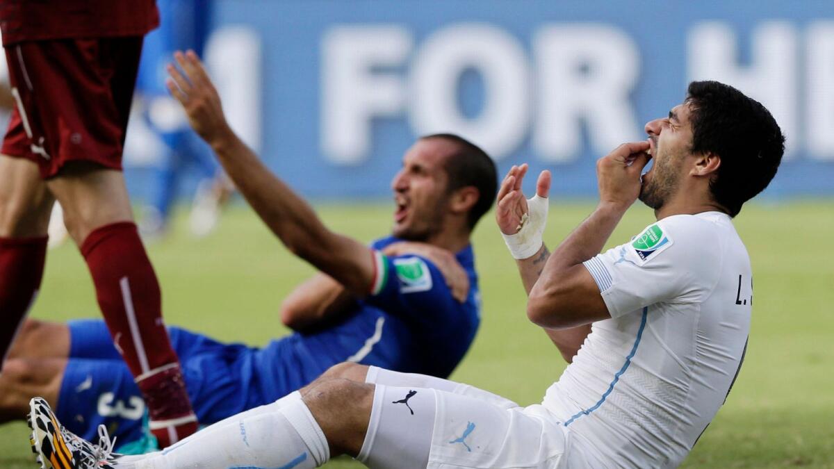 Luis Suarez holds his teeth after colliding with Italy's Giorgio Chiellini's shoulder during the group D World Cup match between Italy and Uruguay in 2014. - AP file