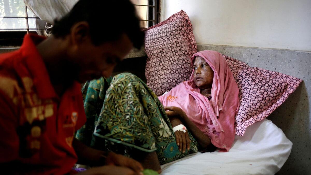 FILE PHOTO: ATTENTION EDITORS - VISUALS COVERAGE OF SCENES OF DEATH OR INJURY   Shaheda, 40, a Rohingya refugee woman who said her body was burnt when the Myanmar army set fire to her house, receives treatment at the Cox's Bazar District Sadar Hospital in Cox's Bazar, Bangladesh, September 13, 2017.  REUTERS/Mohammad Ponir Hossain/File Photo