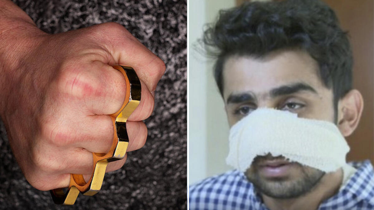 Man smashes Pakistani students face with brass knuckles