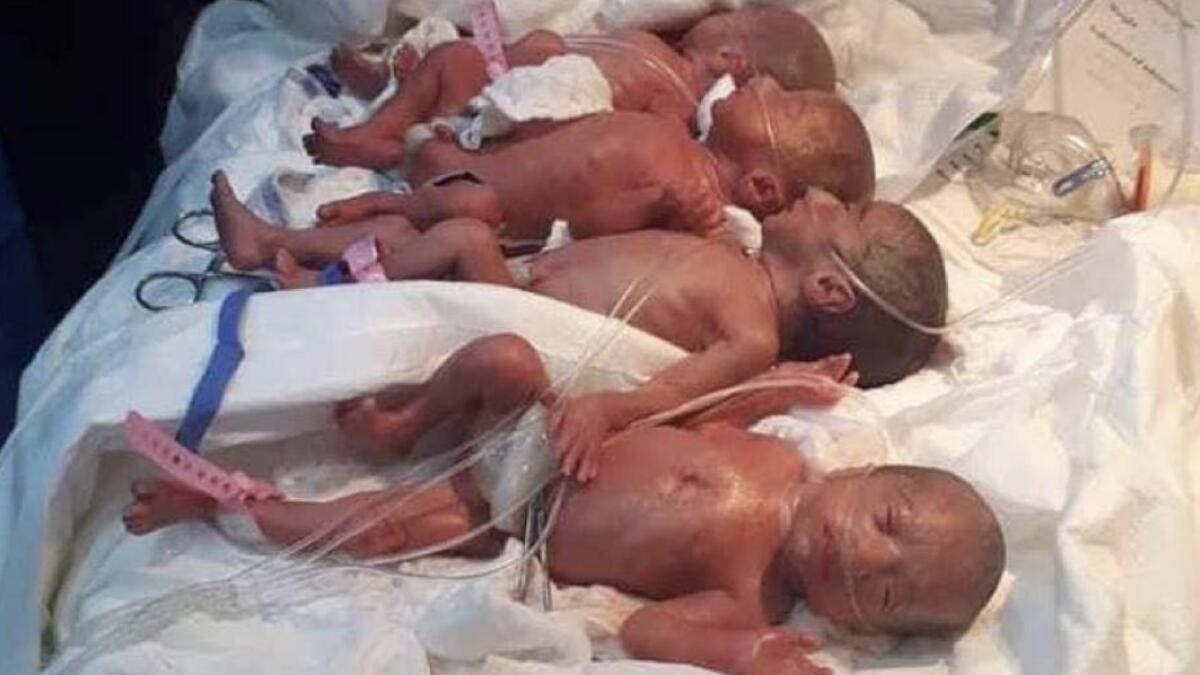 Photos: Woman gives birth to 7 babies in Iraq
