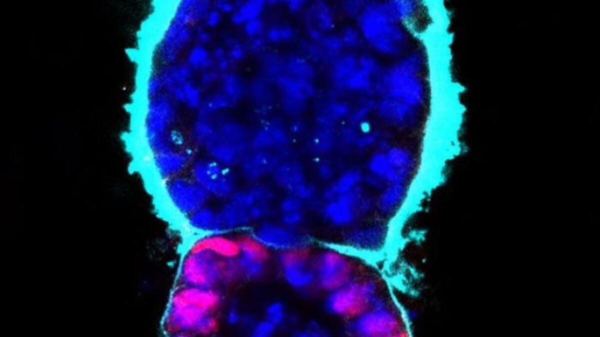 Scientists create first artificial mouse embryo 