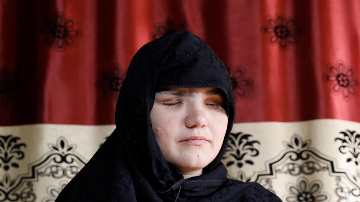 Khatera, 33, an Afghan police woman who was blinded after a gunmen attack in Ghazni province, speaks during an interview in Kabul.