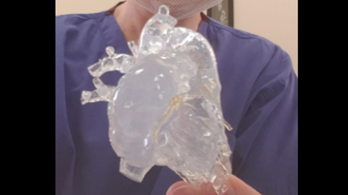 The 3D-printed model of Adam's heart. — Supplied photo