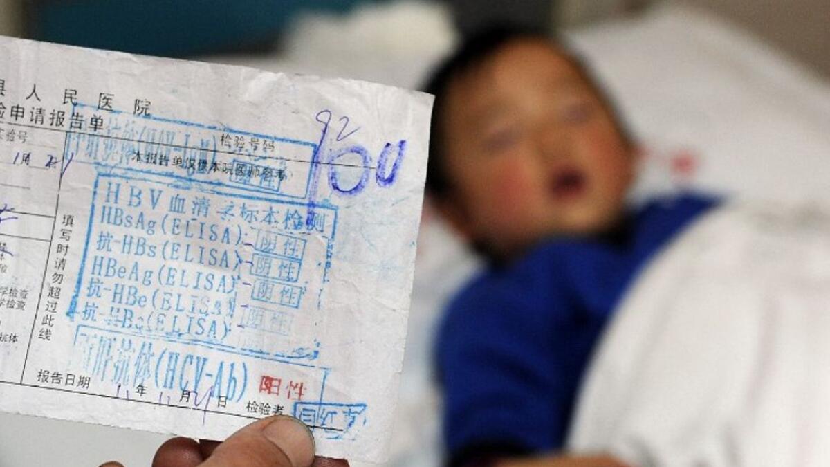 Test result slip showing child has hepatitis C, at a hospital in Hefei. (AFP file)