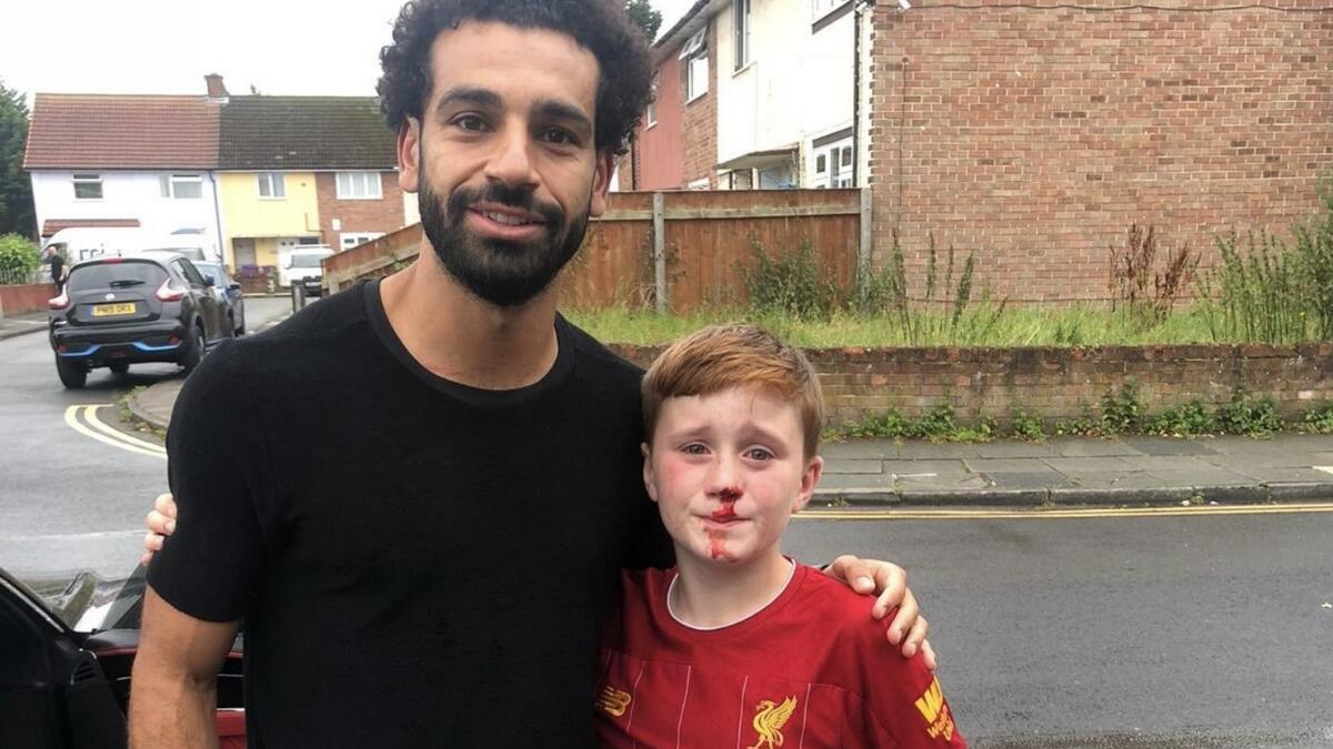 Salah comforts Liverpool fan who injured nose