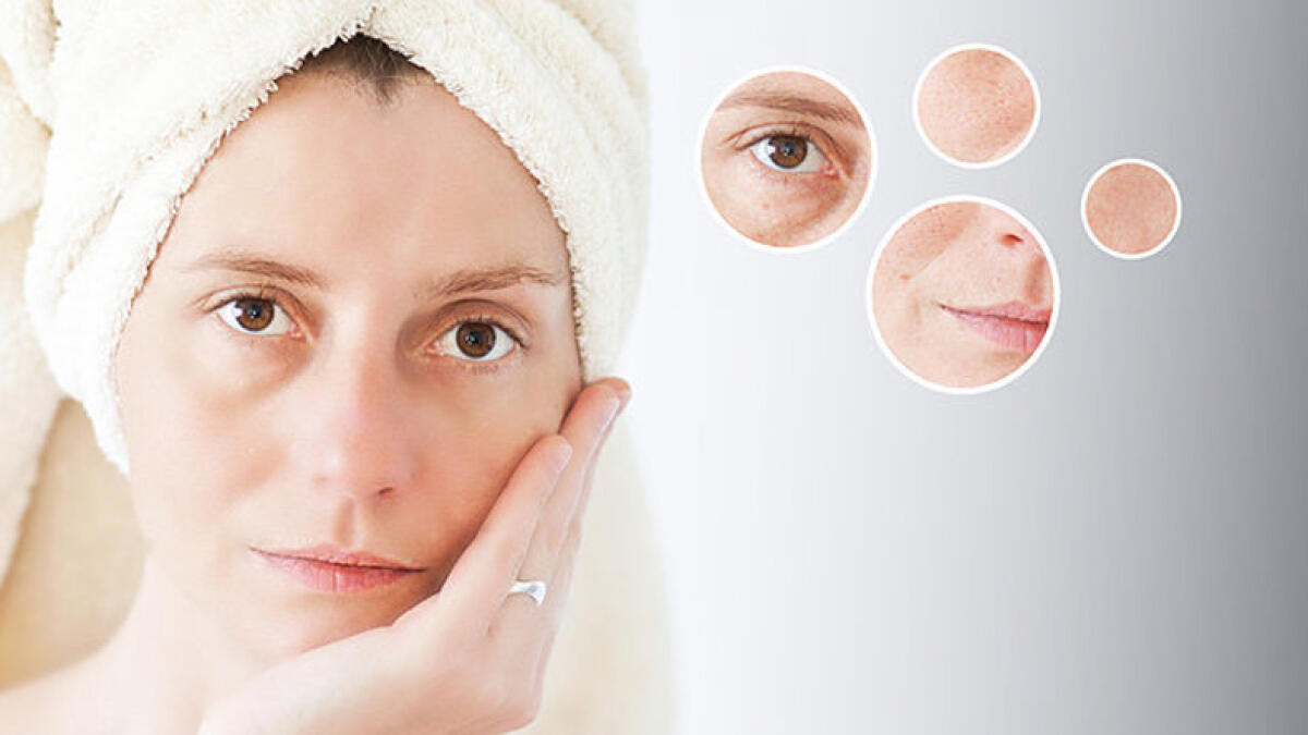 Keep acne at bay-heres how