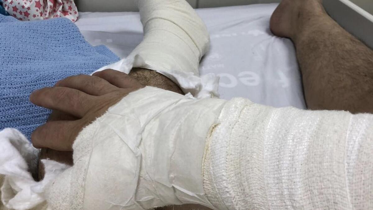 British expat hospitalised after brawl at Dubai cafe
