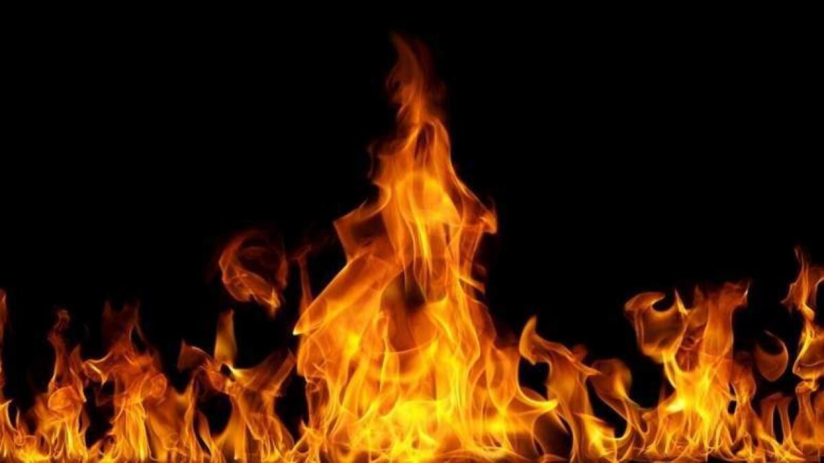 14-year-old sets self, villa garden on fire in UAE  