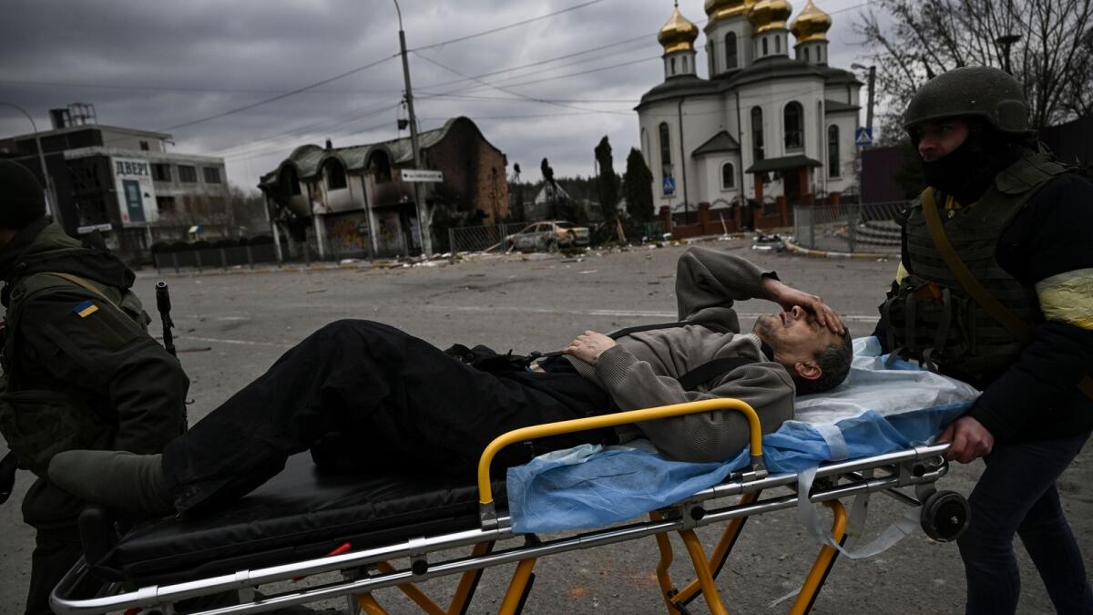 Ukrainian serviceman Andriy Yermolayev, 50, who lost part of his leg during Russian shelling on February 24, is evacuated from the city of Irpin, west of Kyiv, on March 7, 2022. Photo: AFP