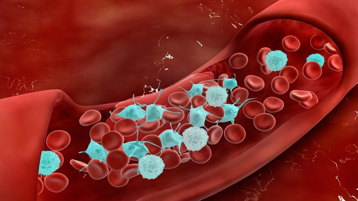 US researchers, Covid-19, coronavirus, associated, life-threatening, blood clots, arteries, legs