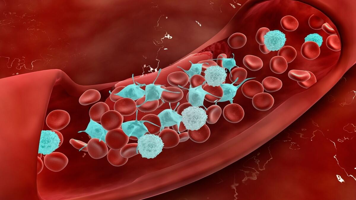 US researchers, Covid-19, coronavirus, associated, life-threatening, blood clots, arteries, legs