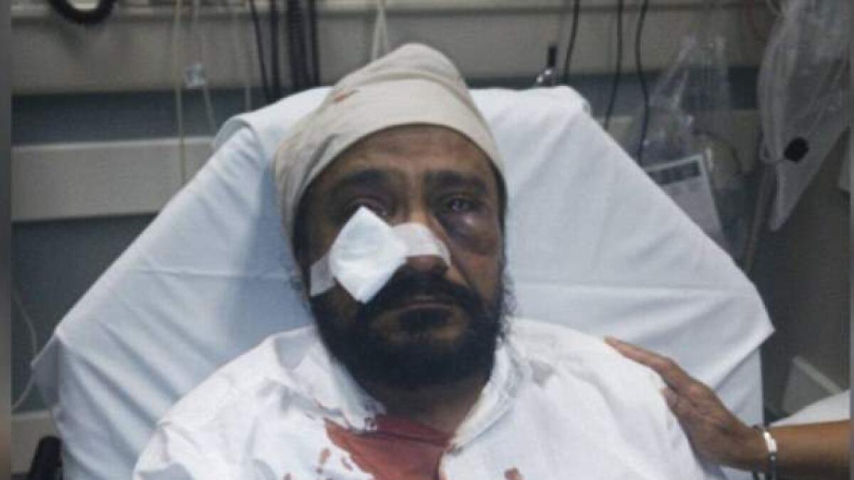 Widespread condemnation for hate crime against Sikh-American