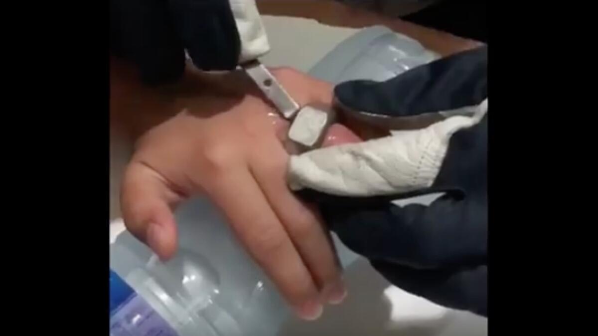 Video: UAE firefighters save 13-year-olds finger stuck in metal nut