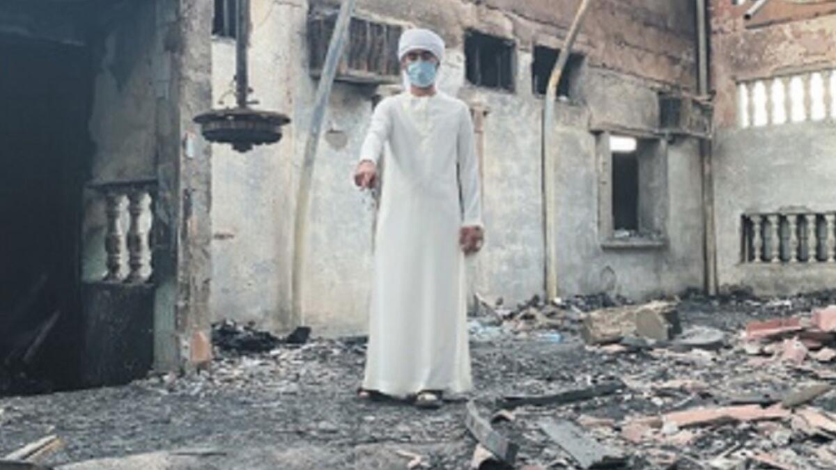 fire, blaze, life, burns, hospital, sons, house, younger, elder, burning, smoke, arms, hands, ras al khaimah, UAE