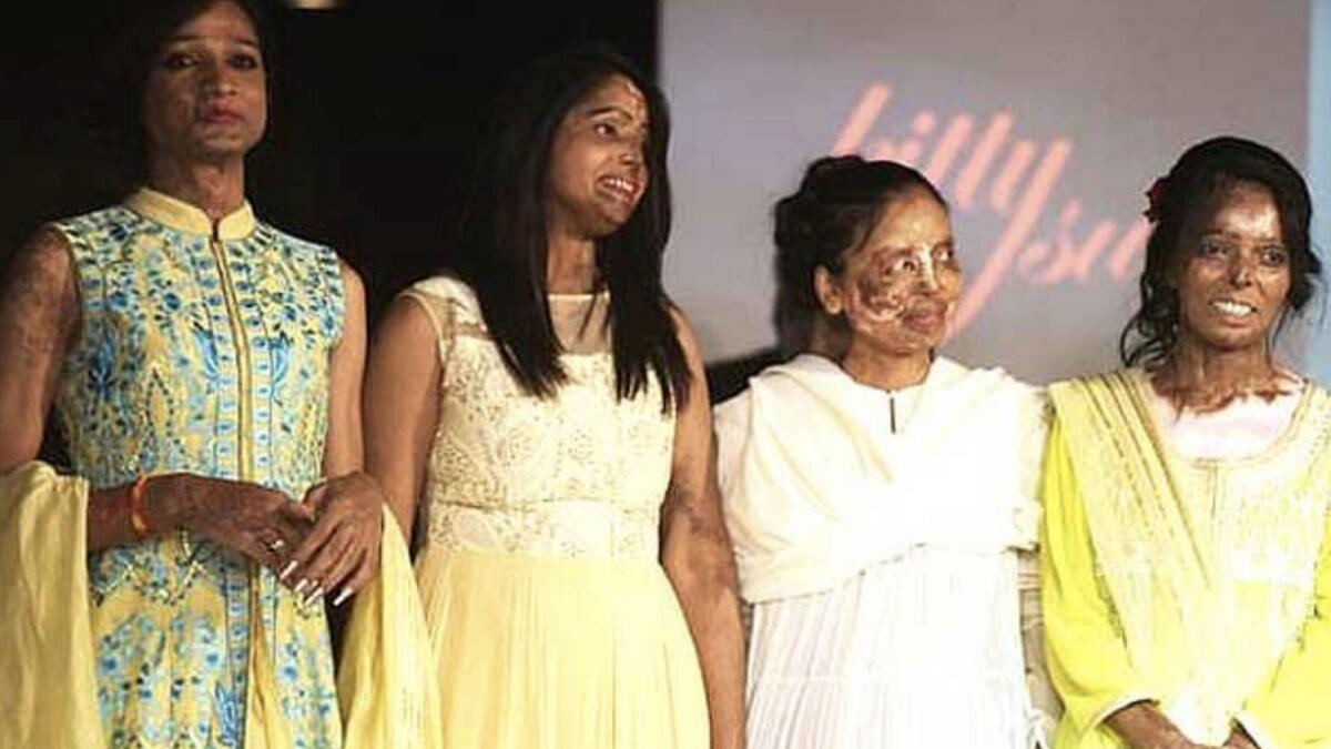  India acid attack victims defiant on haute couture catwalk
