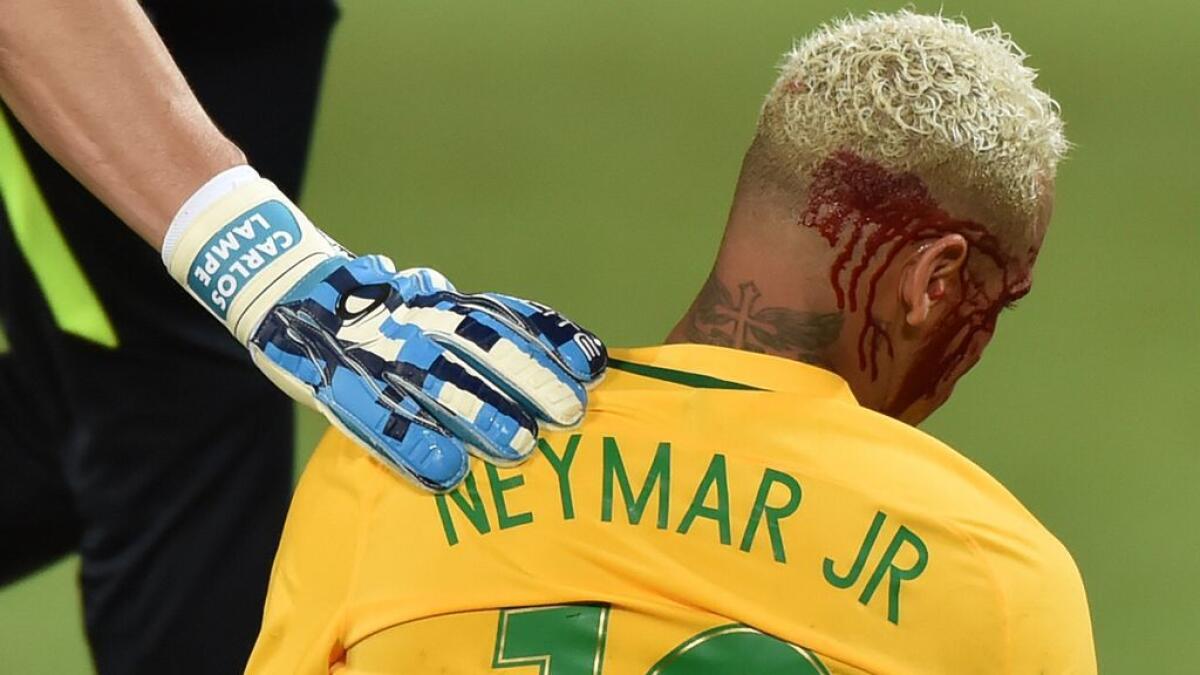 WATCH: Fearless Neymar to play his game despite horrible injury 