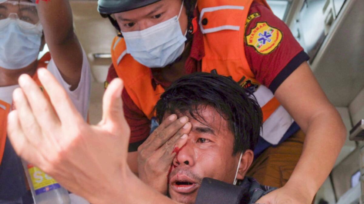 A man, who suffered an eye injury after being hit with a slingshot fired by security forces, is treated by a medical team following a demonstration against the military coup in Mandalay. — AFP file