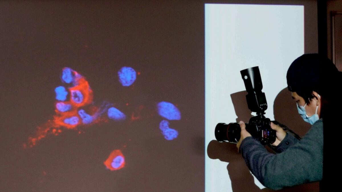A photographer takes photo of a projector image showing immunofluorescence staining of omicron infected Vero E6 cells in Hong Kong. — AP