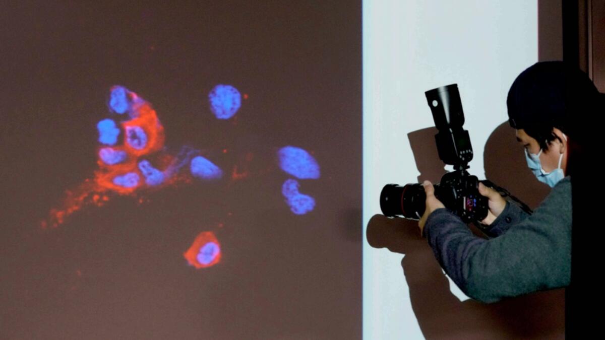 A photographer takes photo of a projector image showing immunofluorescence staining of omicron infected Vero E6 cells in Hong Kong. — AP