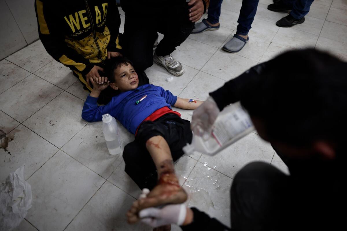 Palestinians wounded in the Israeli bombardment of the Gaza Strip are treated in a hospital in Khan Younis January 15, 2024. — AP