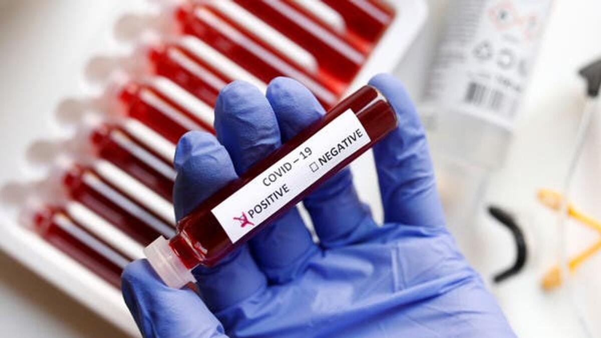Fake blood is seen in test tubes labelled with the coronavirus (COVID-19) in this illustration taken March 17, 2020.