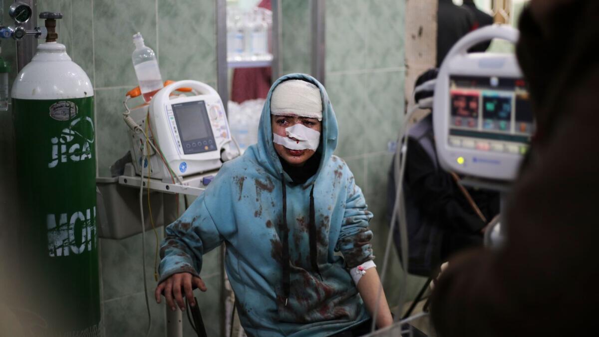 A Palestinian wounded in the Israeli bombardment sits in a hospital In Rafah, Gaza Strip, Saturday, Feb. 10, 2024. AP