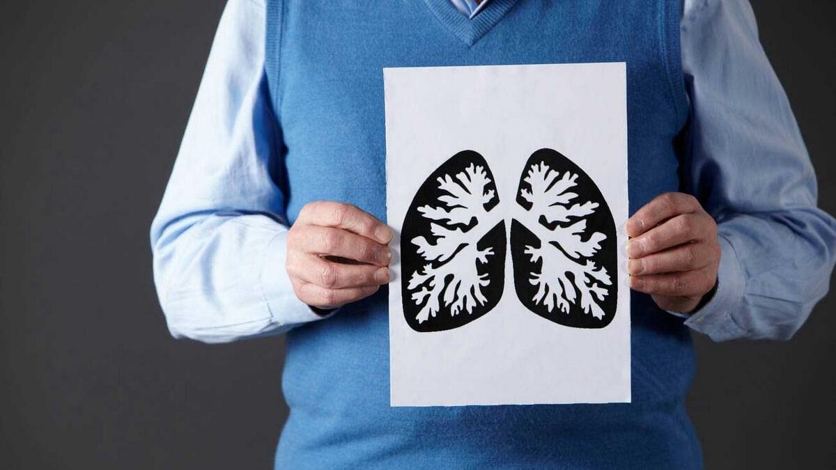 Alarming rise in lung cancer among non-smokers in UAE