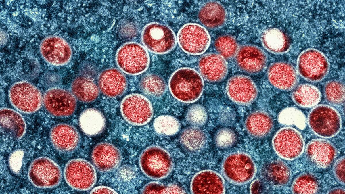 This image provided by the National Institute of Allergy and Infectious Diseases (NIAID) shows a colorised transmission electron micrograph of mpox particles (red) found within an infected cell (blue). (Photo: AP)