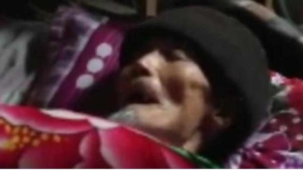 ‘Dead’ man opens his eyes before burial  
