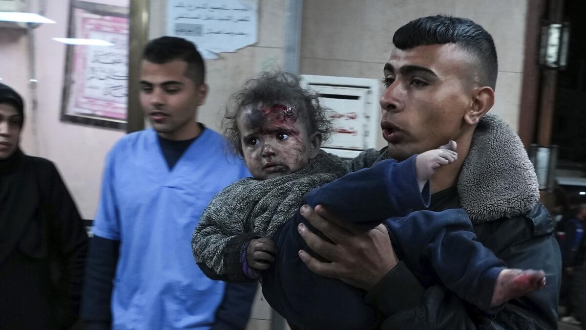 Palestinians wounded in the Israeli bombardment of the Gaza Strip are brought to Al Aqsa hospital in Deir Al Balah. — AP
