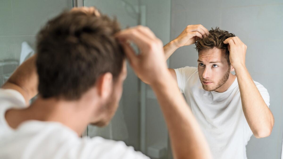 How to get rid of bald patches