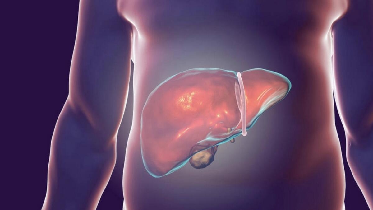 Lifestyle-linked liver diseases see a rise among Emiratis