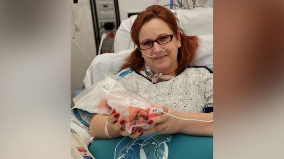 Woman holds her own heart in her hands during surgery