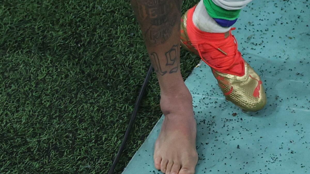 The swollen ankle of Neymar can be seen as he leaves the field after the end of the match. (AFP)