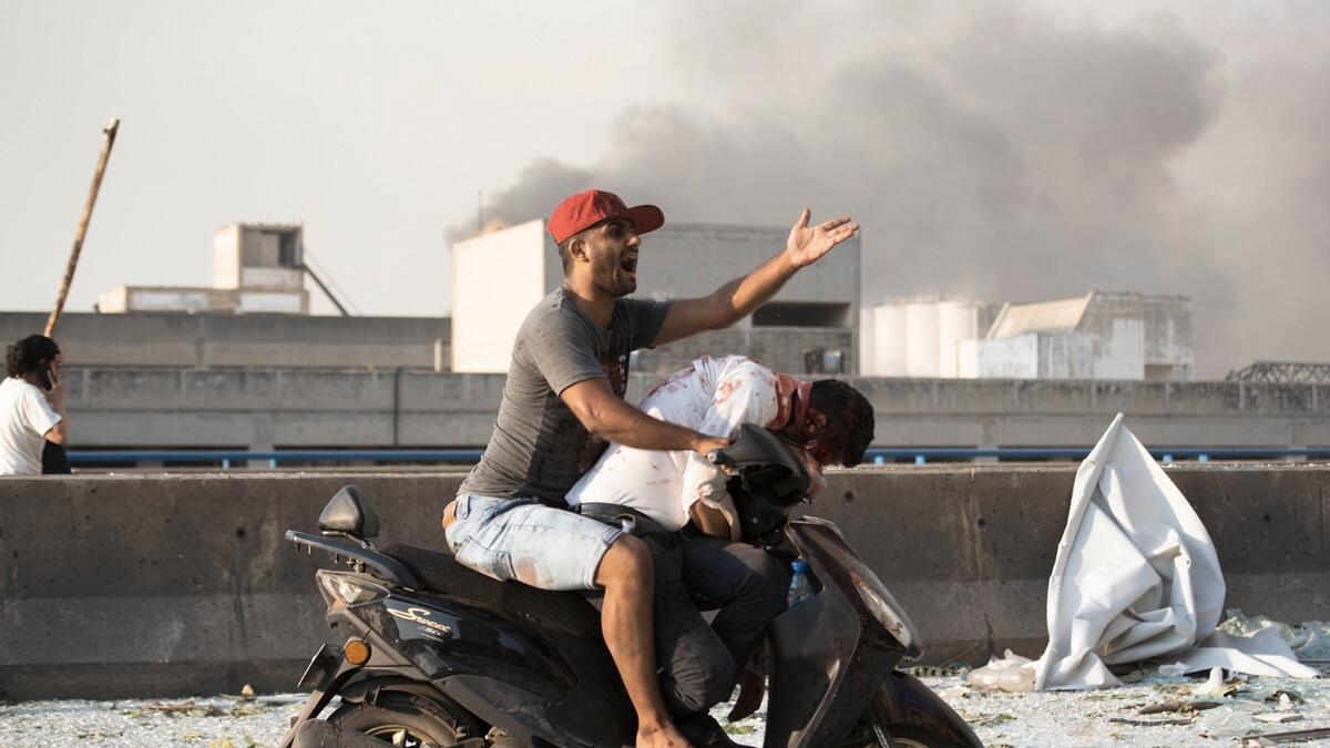 A man evacuates an injured person after a massive explosion in Beirut, Lebanon. Photo: AP